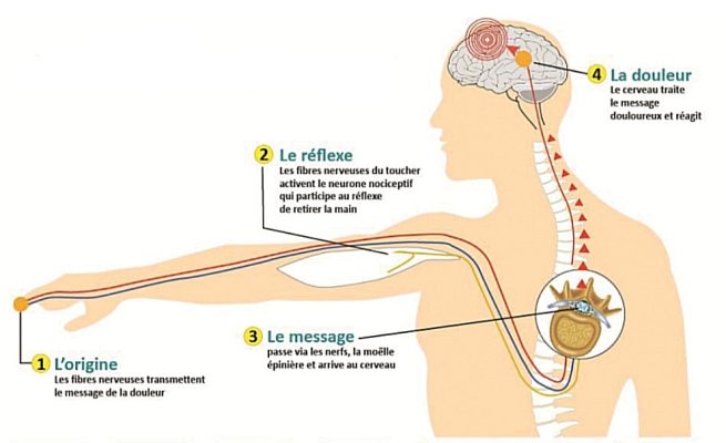 Douleur chronique en ostéopathie - Douleur par excès de nociception - Sellem Ostéo - Ostéopathe Paris 3